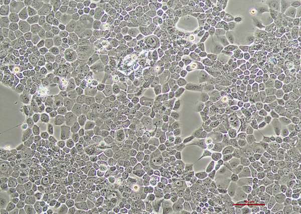 人咽鳞癌细胞FaDu(STR鉴定) | EnkiLife恩玑生命