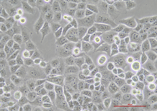 人胰腺癌细胞荧光素酶稳转株PANC-1-LUC(STR鉴定) | EnkiLife恩玑生命