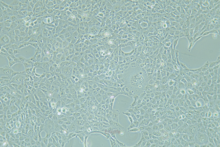 人整合SV40基因的乳腺上皮细胞HBL-100(STR鉴定) | EnkiLife恩玑生命