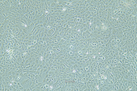 人整合SV40基因的乳腺上皮细胞HBL-100(STR鉴定) | EnkiLife恩玑生命