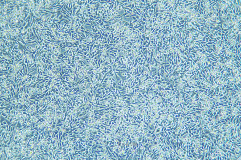 小鼠膀胱癌细胞稳定表达荧光素酶MB49+LUC(种属鉴定) | EnkiLife恩玑生命