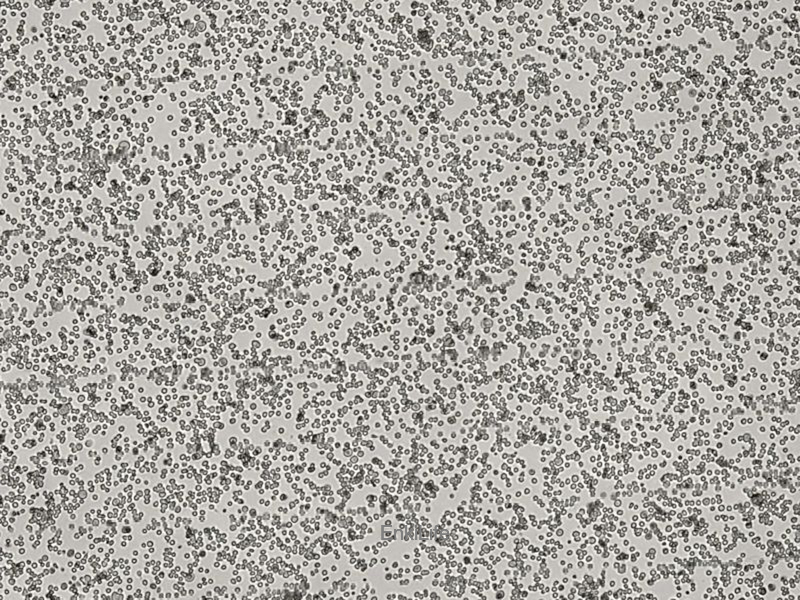 小鼠急性骨髓性白血病细胞C1498(种属鉴定) | EnkiLife恩玑生命