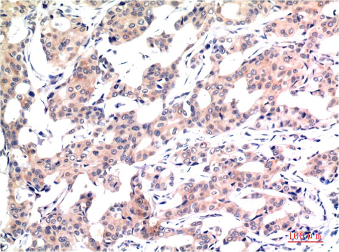 Acetyl-Histone H3 (Lys9) (10F10) Mouse Monoclonal Antibody | 鼠单抗 | EnkiLife恩玑生命