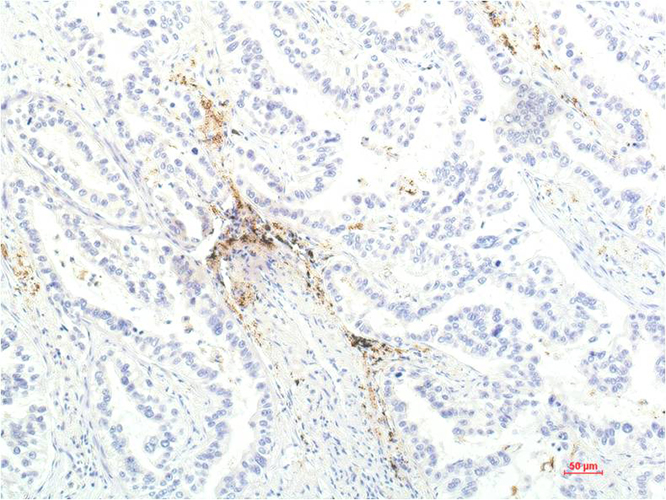 JAK1 (8D8) Mouse Monoclonal Antibody | 鼠单抗 | EnkiLife恩玑生命