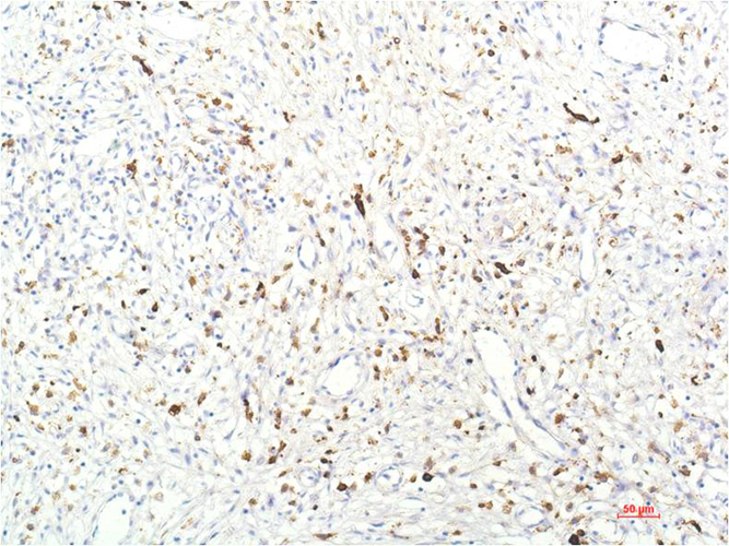 JAK1 (8D8) Mouse Monoclonal Antibody | 鼠单抗 | EnkiLife恩玑生命