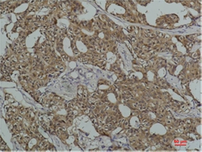 Hsc70 (5C2) Mouse Monoclonal Antibody | 鼠单抗 | EnkiLife恩玑生命
