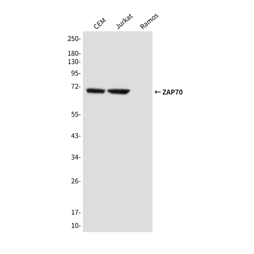 ZAP70 (4B2) Mouse Monoclonal Antibody | 鼠单抗 | EnkiLife恩玑生命