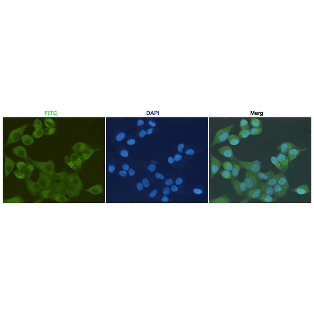 S100A10 (6F4) Mouse Monoclonal Antibody | 鼠单抗 | EnkiLife恩玑生命