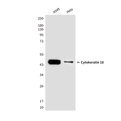 Cytokeratin 18 (6A8) Mouse Monoclonal Antibody | 鼠单抗 | EnkiLife恩玑生命