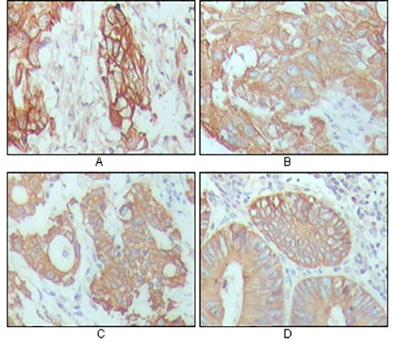 Cytokeratin 18 (6A8) Mouse Monoclonal Antibody | 鼠单抗 | EnkiLife恩玑生命
