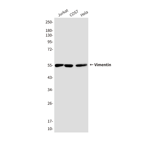 Vimentin (10E2) Mouse Monoclonal Antibody | 鼠单抗 | EnkiLife恩玑生命