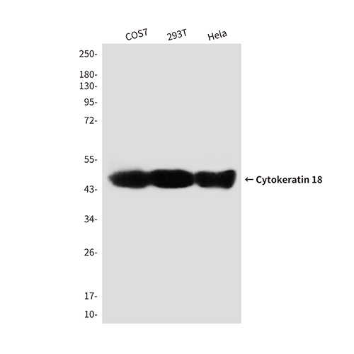 Cytokeratin 18 (2B5) Mouse Monoclonal Antibody | 鼠单抗 | EnkiLife恩玑生命