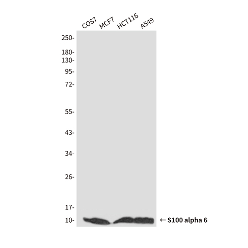 S100A6 (3E11) Mouse Monoclonal Antibody | 鼠单抗 | EnkiLife恩玑生命