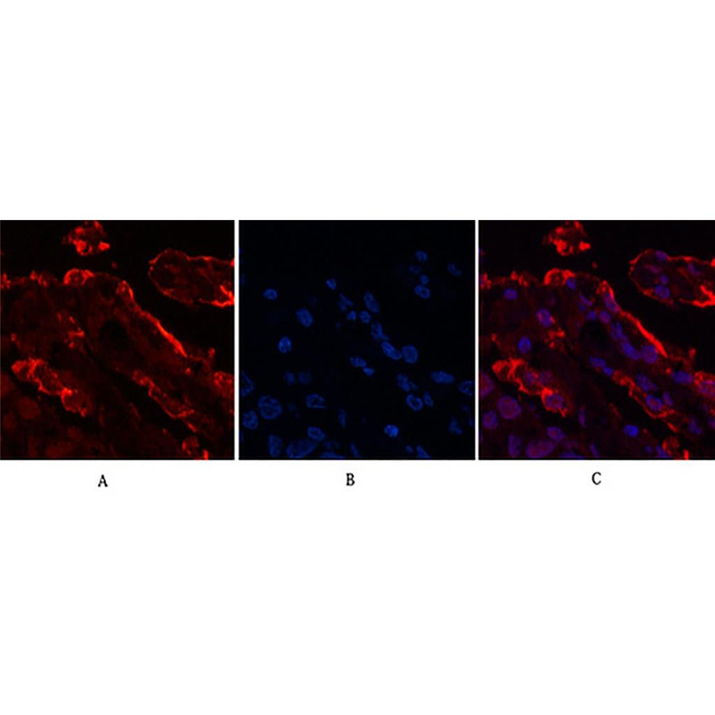 Galectin 3 (4B2) Mouse Monoclonal Antibody | 鼠单抗 | EnkiLife恩玑生命