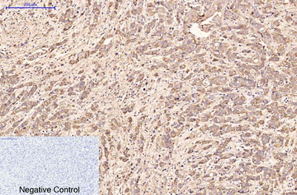 AFP alpha 1 Fetoprotein(17C5)Mouse Monoclonal Antibody | 鼠单抗 | EnkiLife恩玑生命