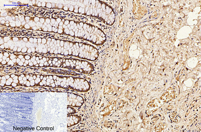 CDX2(14H6)Mouse Monoclonal Antibody | 鼠单抗 | EnkiLife恩玑生命