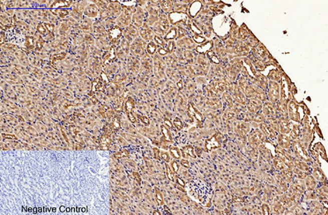 CDX2(14H6)Mouse Monoclonal Antibody | 鼠单抗 | EnkiLife恩玑生命