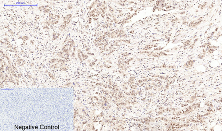 Cleaved PARP(Mix)Mouse Monoclonal Antibody | 鼠单抗 | EnkiLife恩玑生命