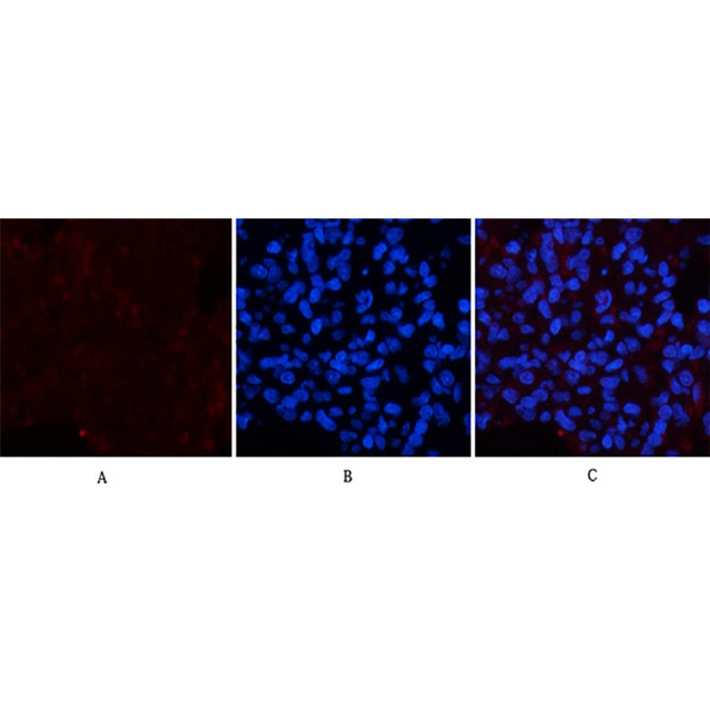 Collagen IV(8E5)Mouse Monoclonal Antibody | 鼠单抗 | EnkiLife恩玑生命