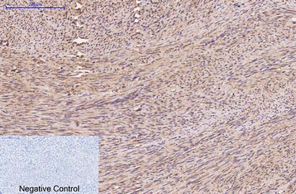FH(7F1)Mouse Monoclonal Antibody | 鼠单抗 | EnkiLife恩玑生命