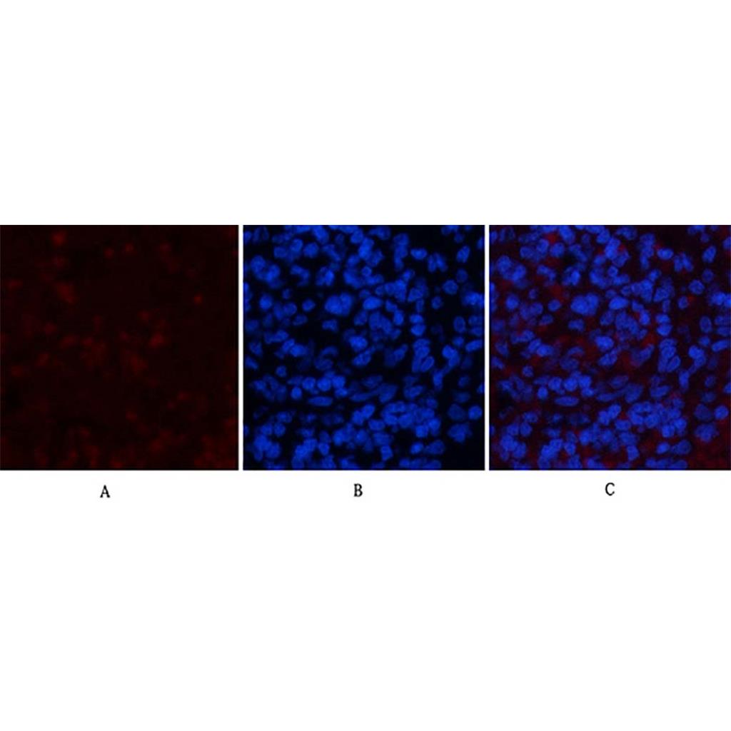 NBR1(7C3)Mouse Monoclonal Antibody | 鼠单抗 | EnkiLife恩玑生命
