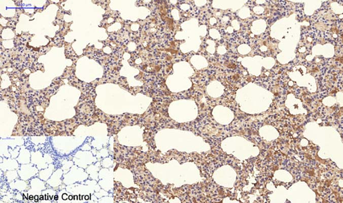 NBR1(7C3)Mouse Monoclonal Antibody | 鼠单抗 | EnkiLife恩玑生命