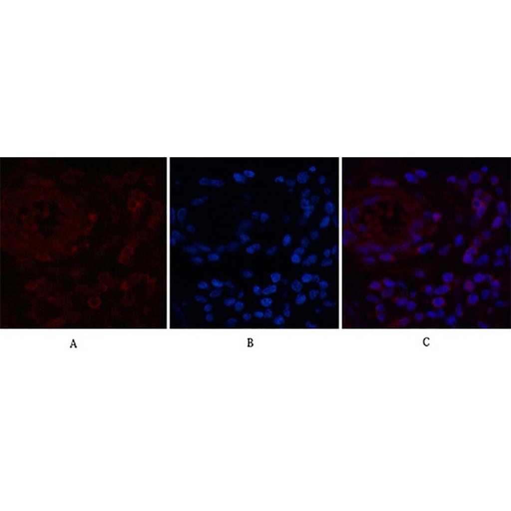 NFkB p65(5G6)Mouse Monoclonal Antibody | 鼠单抗 | EnkiLife恩玑生命