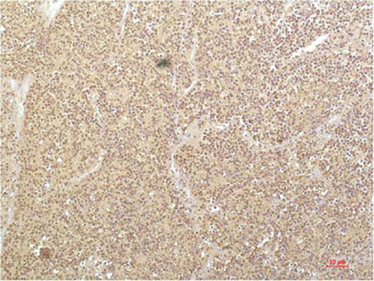 SGK1(4D12)Mouse Monoclonal Antibody | 鼠单抗 | EnkiLife恩玑生命