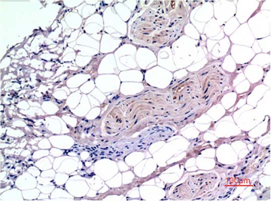 Smad3(4C9)Mouse Monoclonal Antibody | 鼠单抗 | EnkiLife恩玑生命