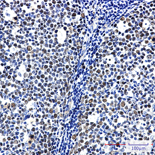 MCM6 Rabbit Monoclonal Antibody | 兔单抗 | EnkiLife恩玑生命