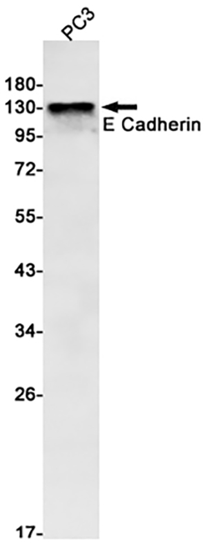E Cadherin Rabbit Monoclonal Antibody | 兔单抗 | EnkiLife恩玑生命