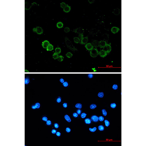 E Cadherin Rabbit Monoclonal Antibody | 兔单抗 | EnkiLife恩玑生命