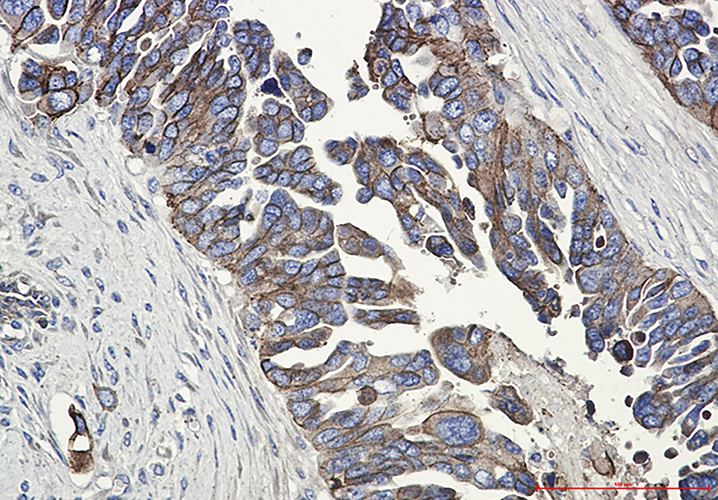 E Cadherin Rabbit Monoclonal Antibody | 兔单抗 | EnkiLife恩玑生命