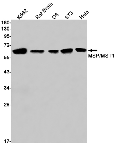 MSP Rabbit Monoclonal Antibody | 兔单抗 | EnkiLife恩玑生命