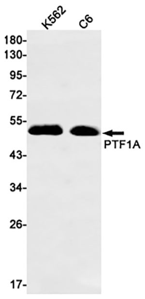 PTF1A Rabbit Monoclonal Antibody | 兔单抗 | EnkiLife恩玑生命