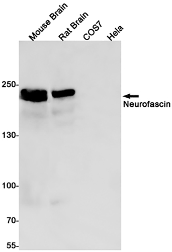 Neurofascin Rabbit Monoclonal Antibody | 兔单抗 | EnkiLife恩玑生命