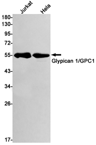 Glypican 1 Rabbit Monoclonal Antibody | 兔单抗 | EnkiLife恩玑生命