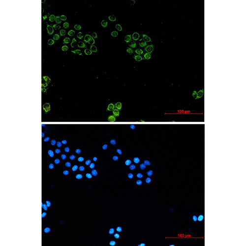 Glypican 1 Rabbit Monoclonal Antibody | 兔单抗 | EnkiLife恩玑生命