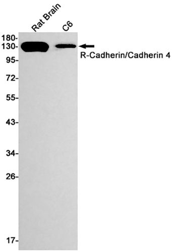 R Cadherin Rabbit Monoclonal Antibody | 兔单抗 | EnkiLife恩玑生命