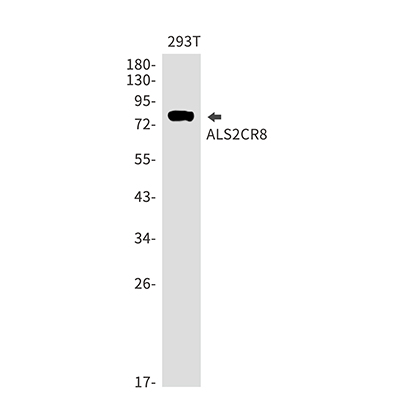 ALS2CR8 Rabbit Monoclonal Antibody | 兔单抗 | EnkiLife恩玑生命