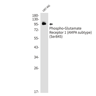 Phospho-Glutamate Receptor 1 (AMPA Subtype) (Ser845) Rabbit Monoclonal Antibody | 兔单抗 | EnkiLife恩玑生命