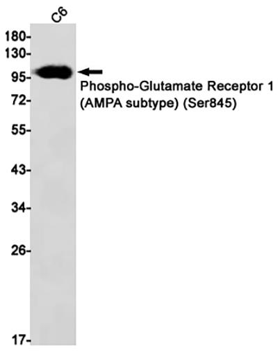 Phospho-Glutamate Receptor 1 (AMPA Subtype) (Ser845) Rabbit Monoclonal Antibody | 兔单抗 | EnkiLife恩玑生命