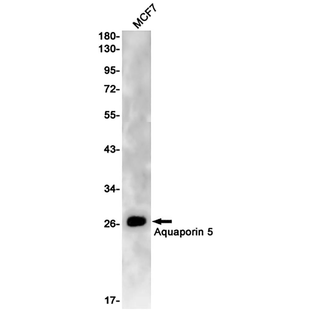 Aquaporin 5 Rabbit Monoclonal Antibody | 兔单抗 | EnkiLife恩玑生命