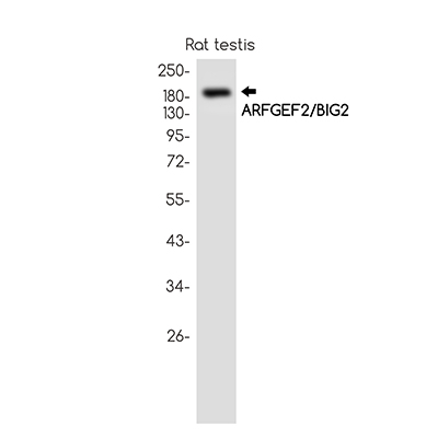 ARFGEF2 Rabbit Monoclonal Antibody | 兔单抗 | EnkiLife恩玑生命