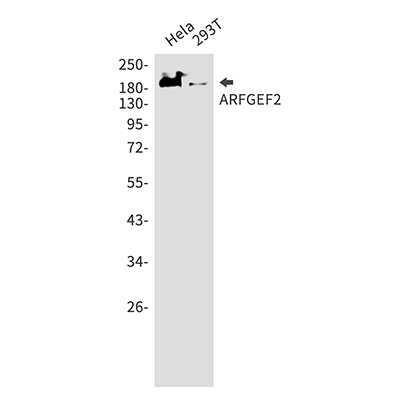 ARFGEF2 Rabbit Monoclonal Antibody | 兔单抗 | EnkiLife恩玑生命