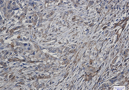 ATG4C Rabbit Monoclonal Antibody | 兔单抗 | EnkiLife恩玑生命
