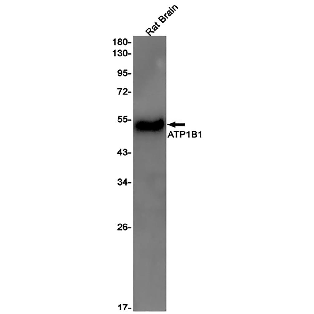 ATP1B1 Rabbit Monoclonal Antibody | 兔单抗 | EnkiLife恩玑生命