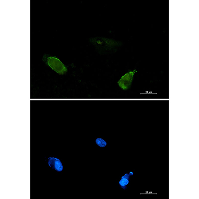 BIN1 Rabbit Monoclonal Antibody | 兔单抗 | EnkiLife恩玑生命