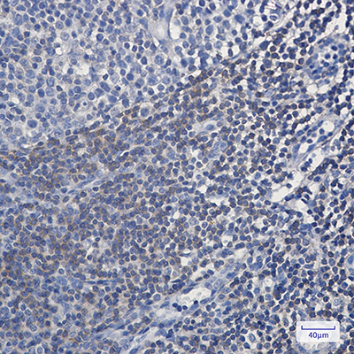 BIN1 Rabbit Monoclonal Antibody | 兔单抗 | EnkiLife恩玑生命
