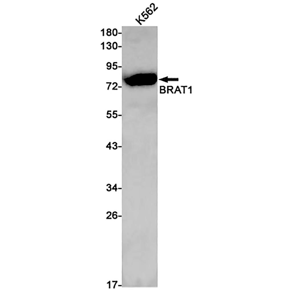 BRAT1 Rabbit Monoclonal Antibody | 兔单抗 | EnkiLife恩玑生命